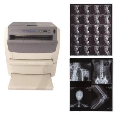 Agfa/FUJI/Canon/Epson Medical X Ray Blue/White Films Manufacturer