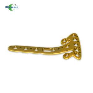 Orthopedic Implants Volar Distal Radius Locking Plate Variable Angle