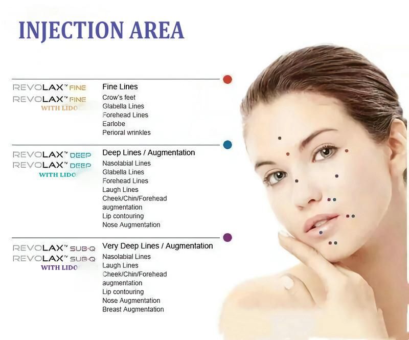 Korea CE Revoax Fine Deep Sub-Q Cross Linked Hyarulonic Dermal Filler Injectable Dermal Filler