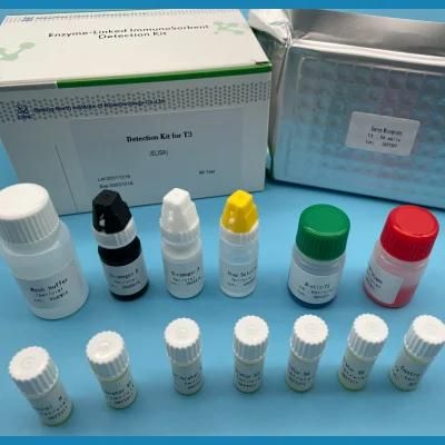 Hbcab Elisa Test Kit/Hepatitis B Surface Antigen Elisa Hospital Detection Test Reagent