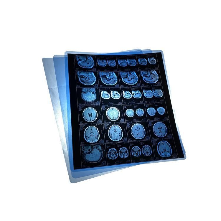 High Quality Medical X Ray Blue Film Dental X Ray Film for Dr/Cr/CT