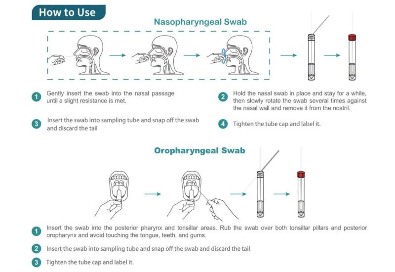 Medical Hospital Lab Viral Sampling Kits Flocked Collection Swab