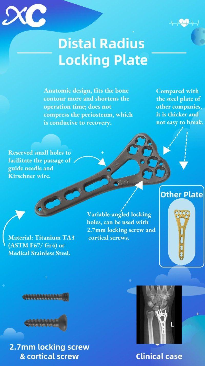 Surgical Implants Universal Distal Radius Orthopedic Bone Locking Plate