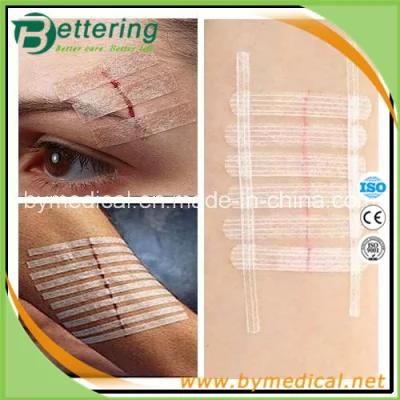 6*100mm Micropore Hypoallergenic Skin Closure of Wound Strips