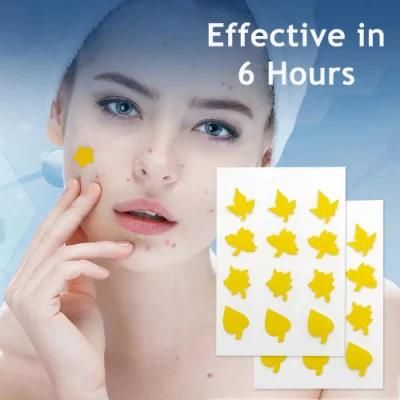 Alps Factory Direct Hydrocolloid Pimple Customized ODM Acne Patch