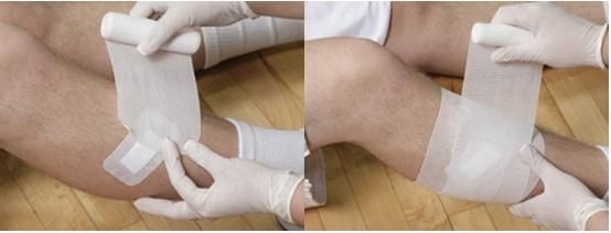 Mdr CE Approved Low Price with Different Size (PBT) White Conforming Bandage