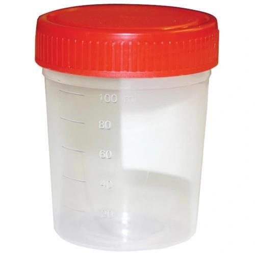 Sample Container/Urine Container/Specimen Container/Urine Sample Container