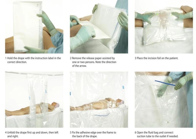 Surgical Drape Vertical Transparent Isolation Drape Transparent PE Drape OEM