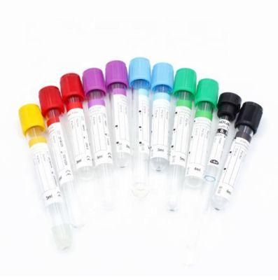 Pet Glass Sodium Citrate Additive Blue Cap Disposable Blood Collection Tube Medical Vacuum Blood Collection Tube