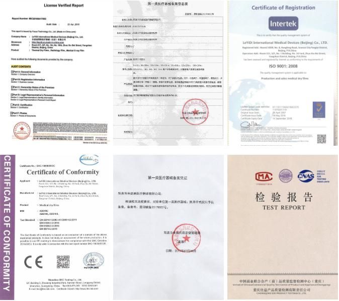 Medical X-ray Film Inkjet Film for CT Cr