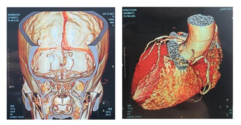 11*14 and 14*17 Inch X-ray Medical Pet Inkjet Blue Films