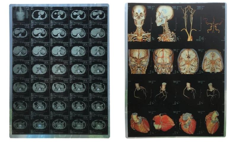 Ultrasound and Radiography Film Inkjet Films