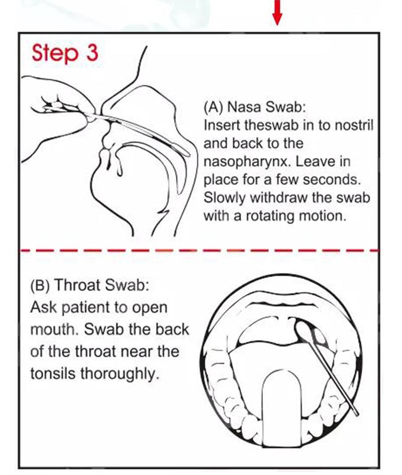 Analysis Sample Collection Swab Kit /Vtm Transport Medium Tube Kit with Swab