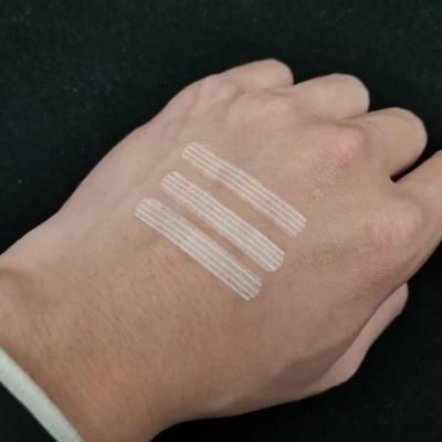 Free Sample Disposable Medical Sterile Adhesive Skin Wound Closure Strips