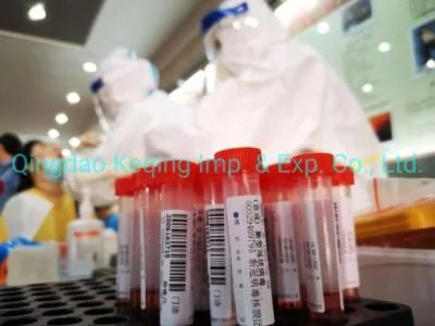 CE Approved Disposable Virus Sampling Tube Vtm Reliable Factory Sale