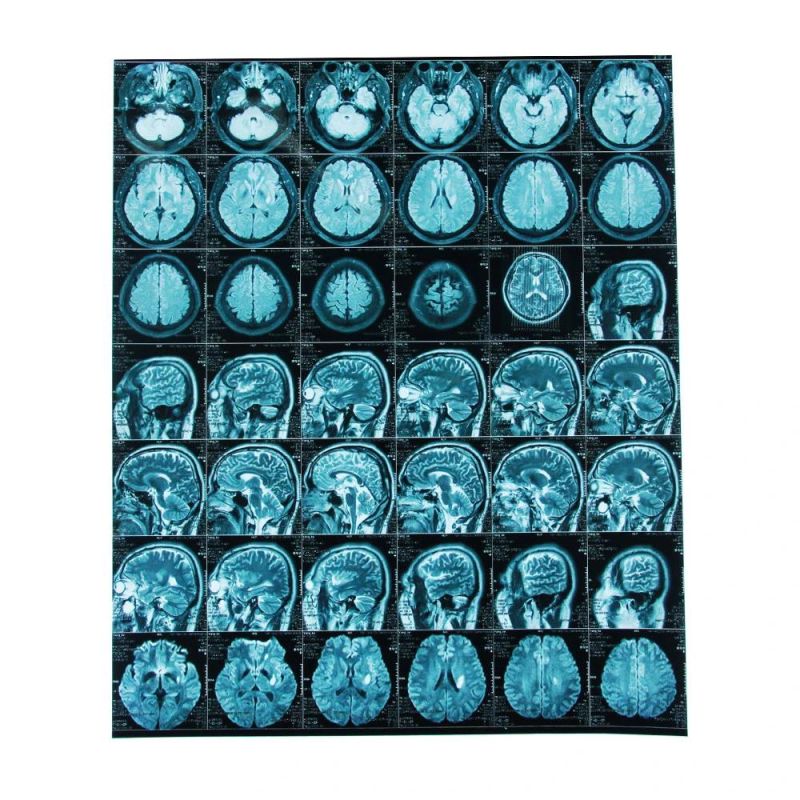 Digital X Ray Film Soft Ware Dicom Print Meidcal Blue Positive Pet Film for CT Cr Dr MRI