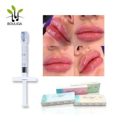 High Quality Hyaluronic Acid Dermal Filler