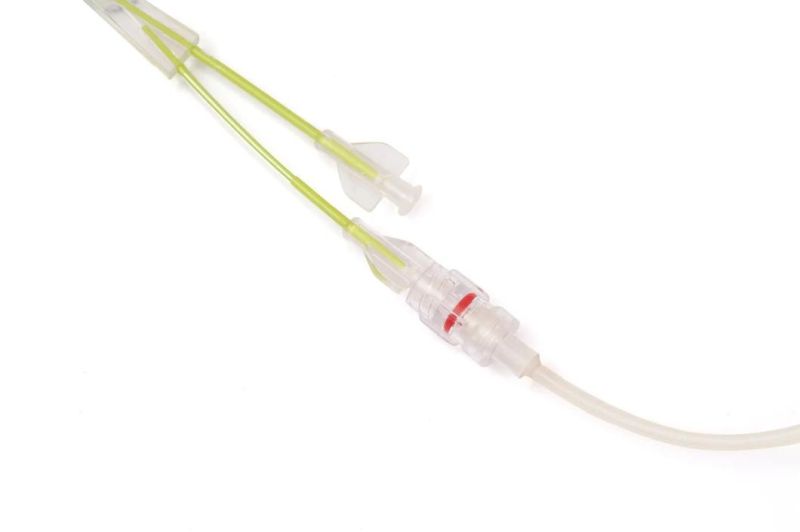 Reborn Medical Ureteral Balloon Dilatation Catheter Solve The Urinary Obstruction with CE Certificate