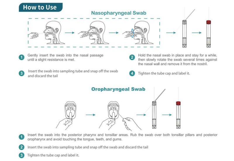 Laboratory Consumable Vtm Sampling Tube Kit with Flocked Oral Nasal Swab Virus Sampling Tube Viral Transport Medium Specimen Collection Swab Rapid Test