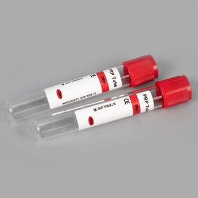 Siny Medical Disposables Serum Vacuum Blood Collection Tubes with CE