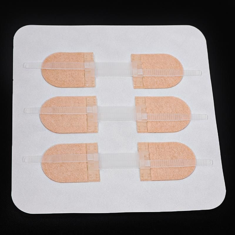 Custom High Quality Medical Suplly Zipper Type Wound Suture Patch