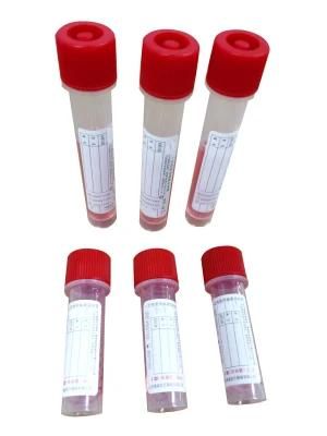 China Factory Directly Supply Disposable Virus Sampling Tube