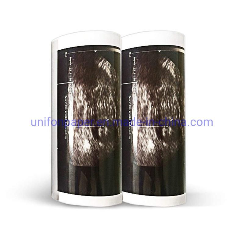Upp-110s Type I Ultrasound Thermal Glossy Paper Roll for Sony Medical Printer