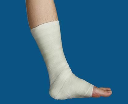 Fiberglass Orthopedic Splint Elastic Bandage for Ankle Joint Fractured Bone External Fixation