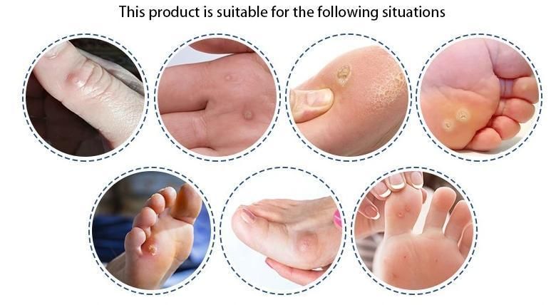 Best Selling Disposable Elastic and Adhesive Bandage/Waterproof