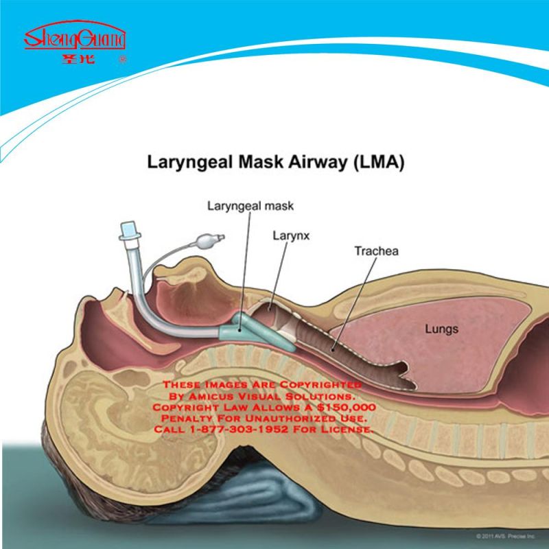 CE Approved Manufacturer Laryngeal Mask Airway