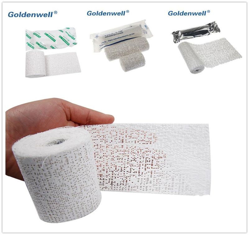 OEM Good Quality Orthopedic Plaster Bandage