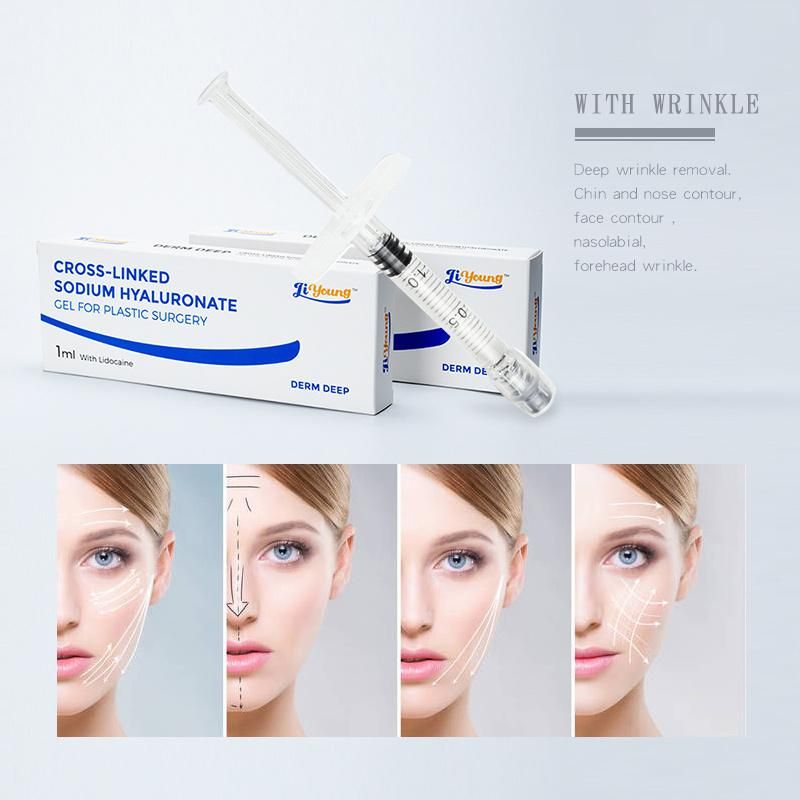 Cross Linked Hyaluronic Acid Injectable Breast Enlargement Dermal Fillers