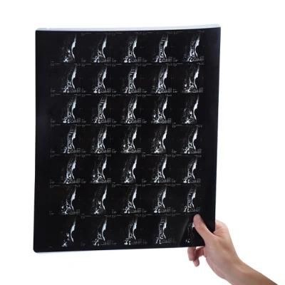 14X17 Inch Pet Dry Blue Xray Medical Radiology Laser Film for Oki Printer