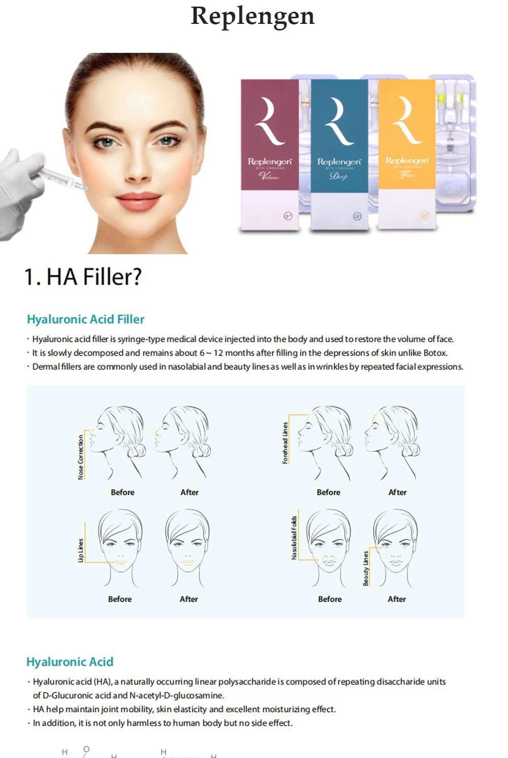 Well Known Brand Replengen Filler Fine Deep Volume Crosslinked Dermal Filler Injection Skin Beauty Product with Best Price