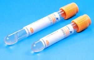 Disposable Vacuum Blood Collection Tube with CE ISO