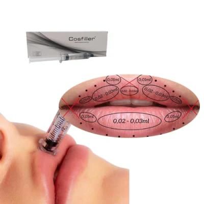 Syringe Dermal Filler Injectable Ha Serum Injection Hyaluronic Acid for Lips Cheeks