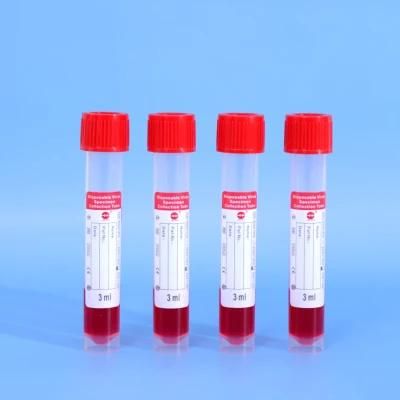 Virus Specimen Sampling Test Swab Tube Collection Universal Viral Transport Media Virus Specimen Collection Tube