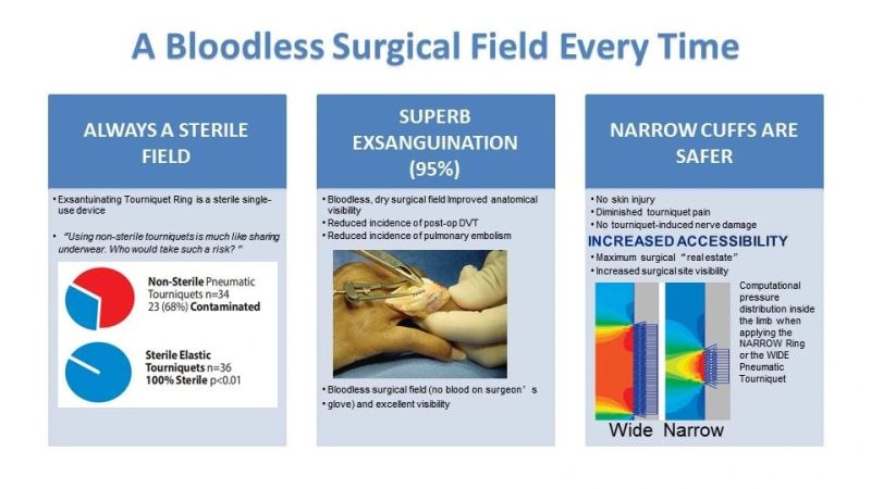 Easy to Use Sterile Tourniquet Latex Free Elastic Exsanguinating Tourniquet Ring Pneumatic Tourniquet to Provide Bloodless Environment in Limb Surgery