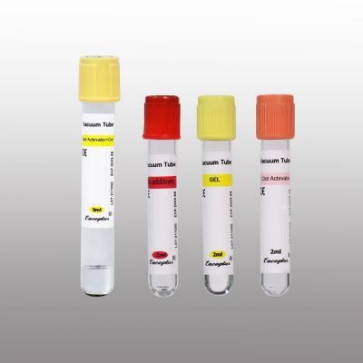 Siny Medical Disposable Serum Vacuum Blood Collection Tubes Gel Tube