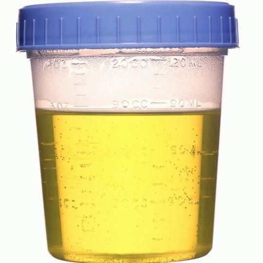 Factory Pricre Super Quality Sterile Specimen Urine Cup Collection Container Different Volumes