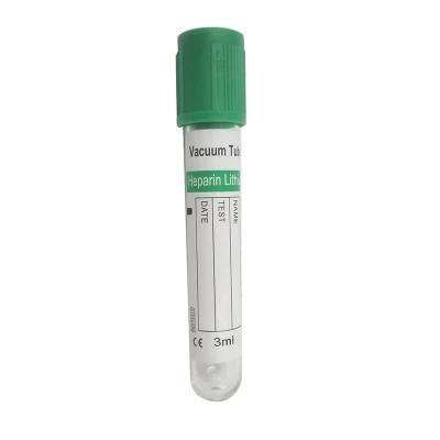 Geen Cap Clot Activator Sodium Citrate Coagulation Disposable Vacuum Blood Collection Tube