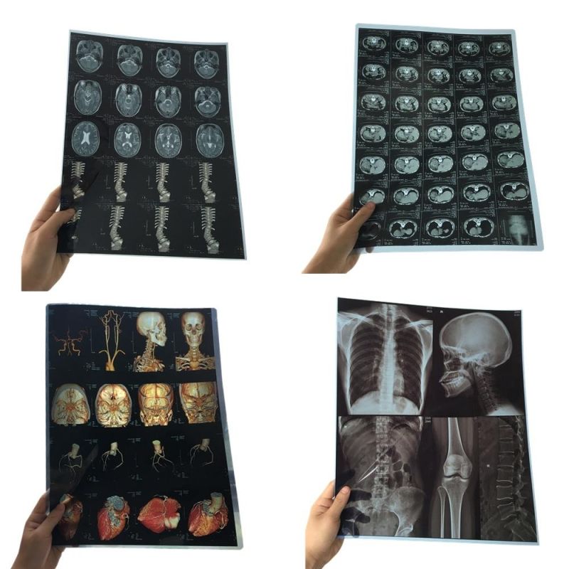 Medical Dry X-ray Film for FUJI Laser Printer