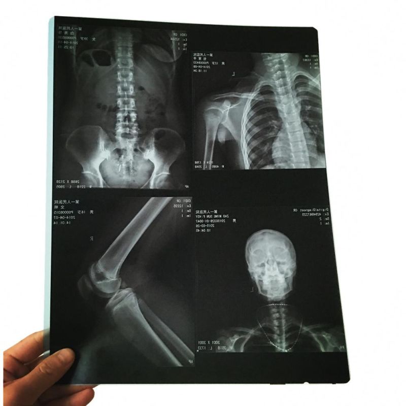 White Color Hospital Ultrasound and Radiology Department Xray Film