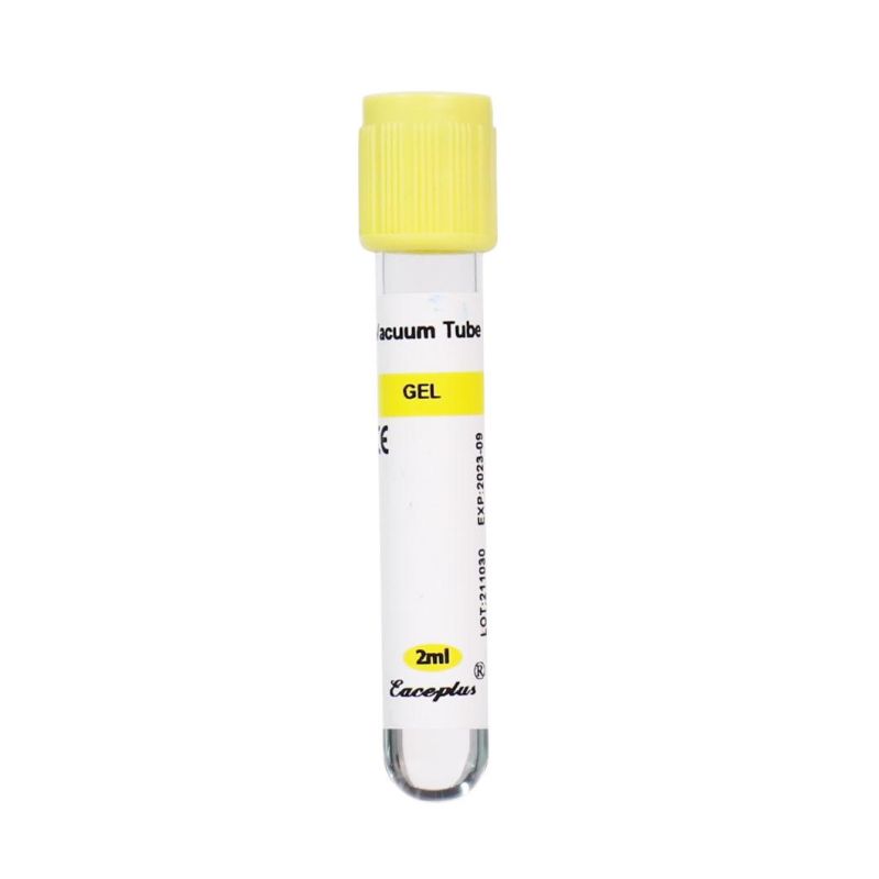 Siny Medical Disposable Serum Vacuum Blood Collection Tubes Gel Tube