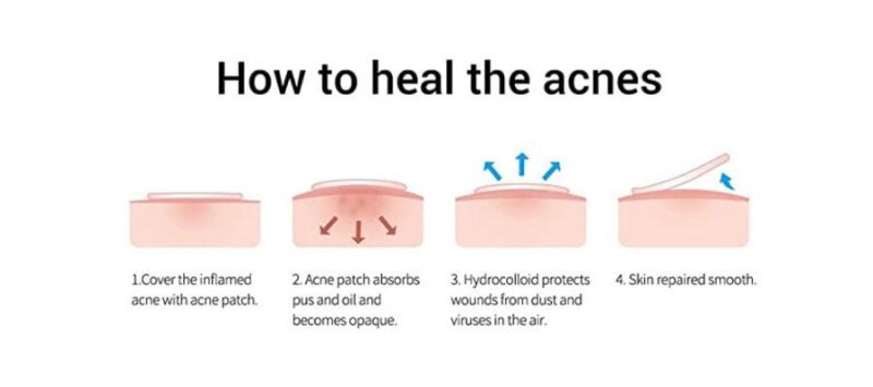 Hb Color Star Acne Healing Patch - Absorption Concentrate Pack, Invisibility, Spots, Hydrocolloid, Skin Comprehensive Treatment, Facial Repair