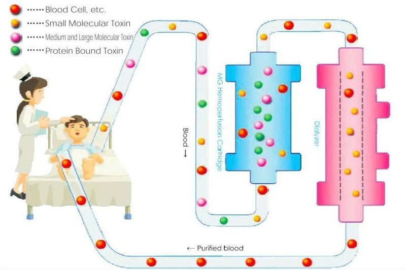 Hemoperfusion Cartridge (ESRD)