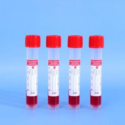 Virus Specimen Collection Kit Nasal Throat Swab Sampling Tube Virus Collection Universal Transport Medium Rna