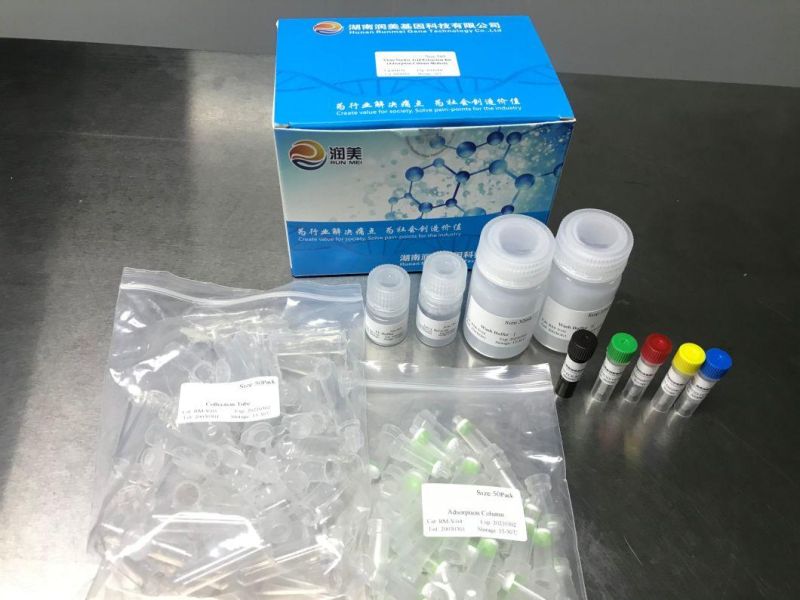Pre-Packed Kit for Detection of Triple Nucleic Acid for Pertussis, Parapertussis,