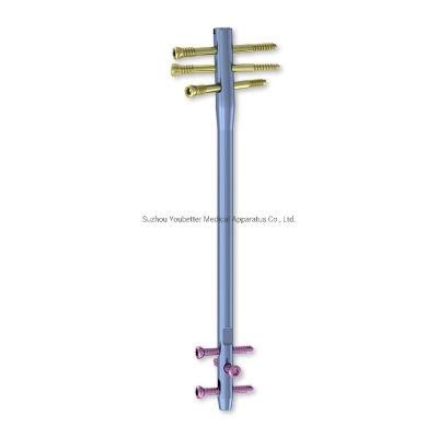 Main Product Femoral Reverse Intramedullary Nail Medical Equipment