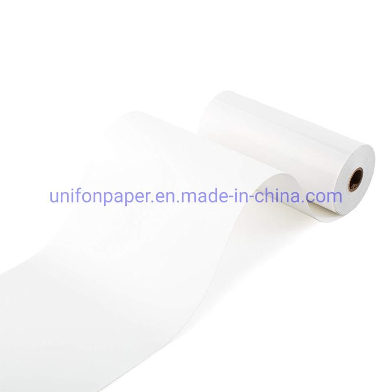 High Glossy Ultrasound Thermal Printing Paper Sony Upp-110hg High Brightness